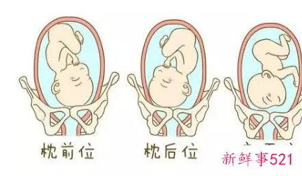 胎位不正怎么调整