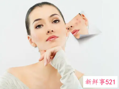 盘点日常美容祛斑小窍门