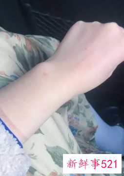 如何在半个月内变成冷白皮