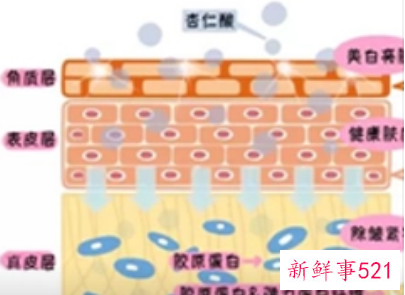 去色素沉着最好的方法刷酸