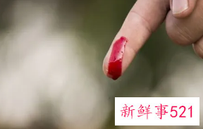 梦见自己喜欢的人满身是血