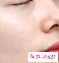 淡斑小秘诀有哪些