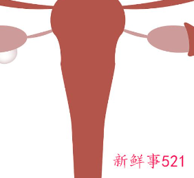 子宫下垂是什么原因引起的