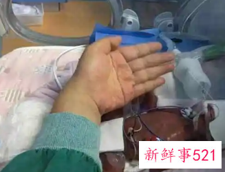 六个月早产儿费用多少