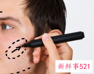 什么眼不适合割双眼皮