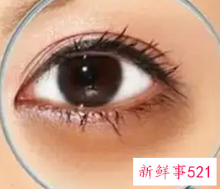 如何减淡黑眼圈