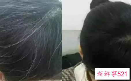 几个食疗偏方摆脱白发