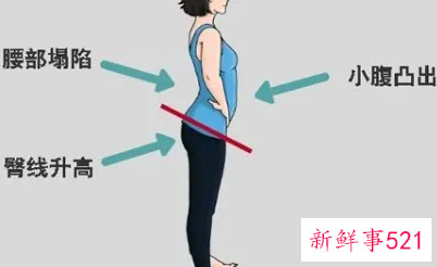 骨盆前倾的危害矫正后会改变吗