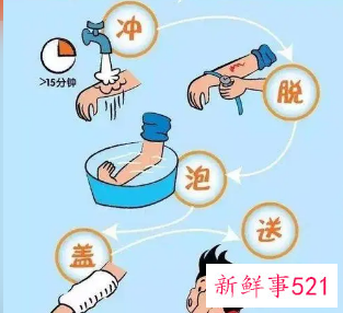 烫伤紧急处理的五个基本步骤是什么
