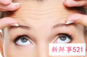 额头有额头纹怎么办