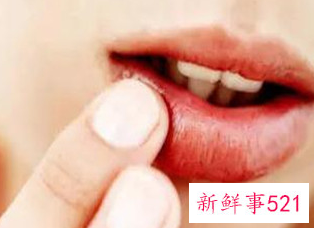 冬季嘴皮干裂是什么原因
