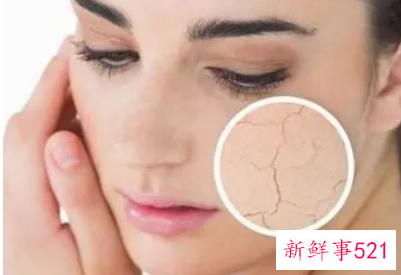 解决秋冬皮肤干燥起皮的方法