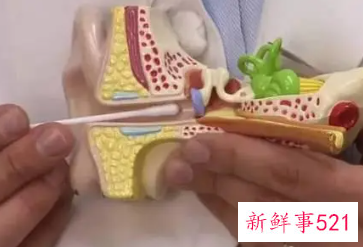 自己挖耳屎的技巧