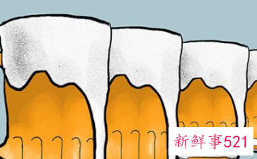 为什么酒鬼的寿命都那么长