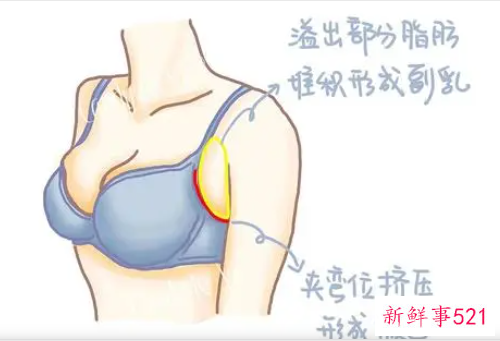 副乳形成于人体生长发育的什么时期