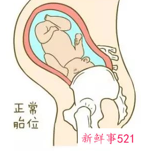 胎位不正怎么调整