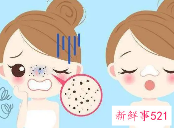 用食用盐可以去黑头吗