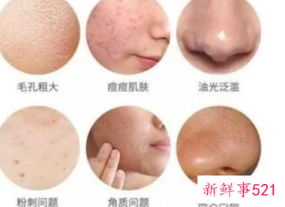 去色素沉着最好的方法刷酸