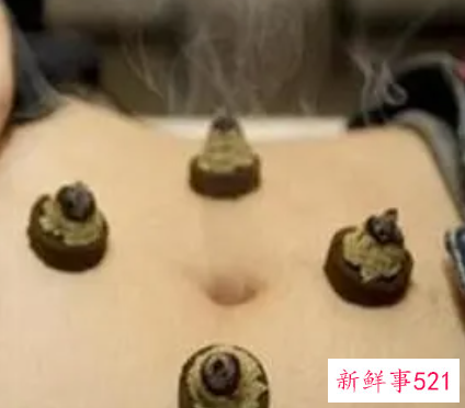 艾灸小肚子能减肥吗