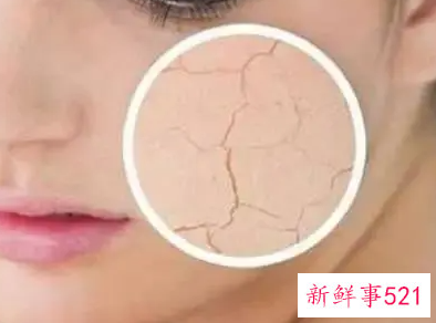 避免去角质的误区