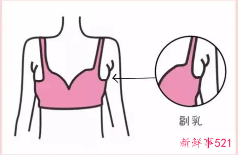 副乳形成于人体生长发育的什么时期
