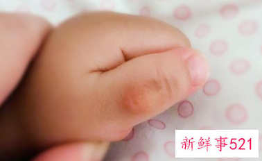 二十个月宝宝吃手指怎么回事