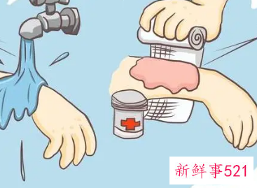 烫伤紧急处理的五个基本步骤是什么