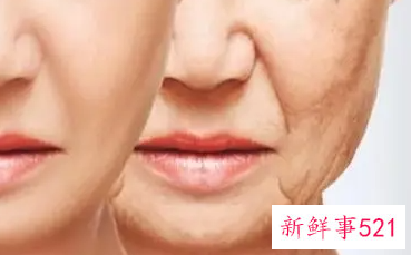 哪些方法可以有效祛皱