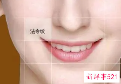 运动法令纹会消除吗