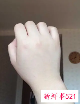 如何在半个月内变成冷白皮