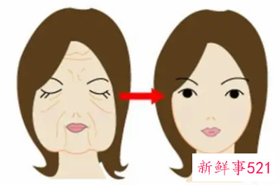 大拉皮手术15天了可以洗澡吗