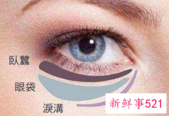 怎样去眼袋最有效啊