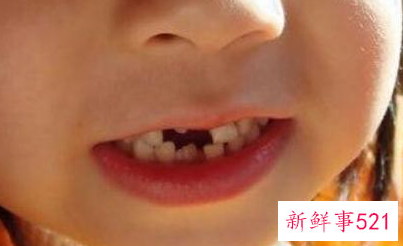 孩子换牙最晚几岁