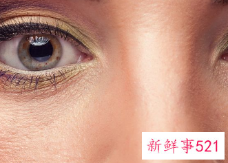 为什么一个双眼皮一个单眼皮