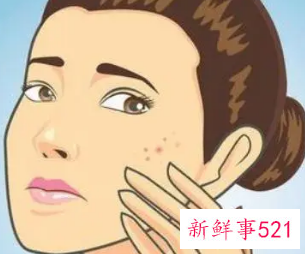 身体皮肤不好怎么改善