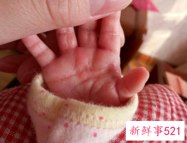 手指肚上起了红色的小点是什么病