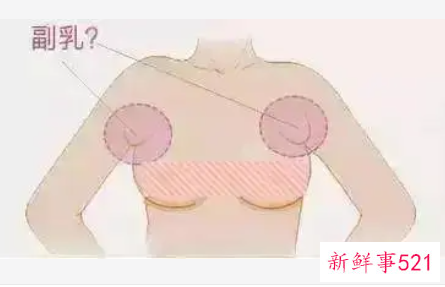 副乳形成于人体生长发育的什么时期