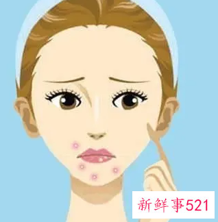 脸上长痘油脂分泌太多小妙招