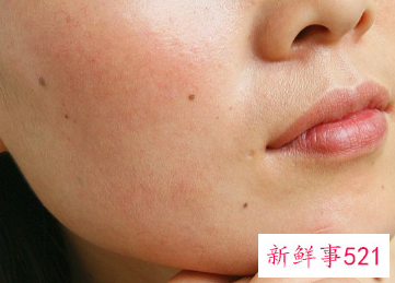 怎样把皮肤里的黑色素代谢出来