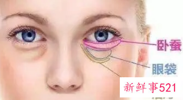 怎样去眼袋最有效啊