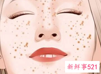 被太阳晒出黑斑怎么办