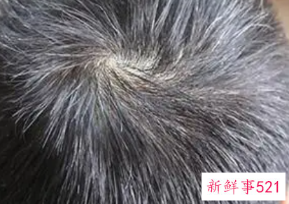 几个食疗偏方摆脱白发