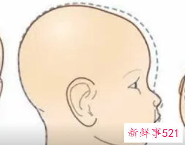 婴儿头朝左歪怎么调整