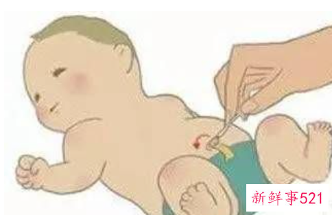 新生儿脐带护理重要吗该怎么做