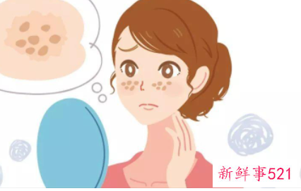 脸上长斑了怎么去除小妙招