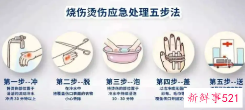 烫伤紧急处理的五个基本步骤是什么