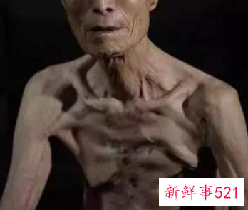 癌症病人要走前的征兆