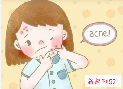 反复长痘痘的原因