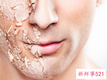 经常给脸补水有没有问题