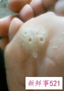 梦见身体破了个洞